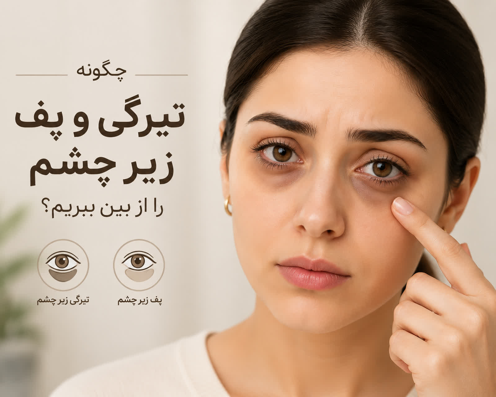 درمان تیرگی و پف زیر چشم، رفع پف و تیرگی دور چشم